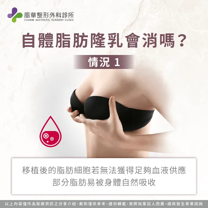 術後部分脂肪被身體自然吸收-自體脂肪隆乳會消嗎