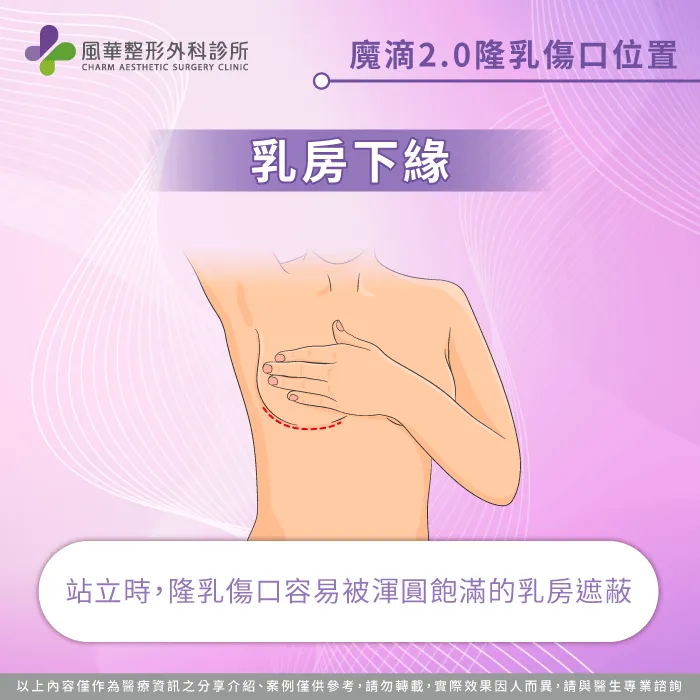 乳房下緣-魔滴2.0隆乳傷口在哪